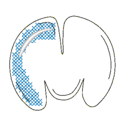 Bubble - Alphabet A-Z – Bild 29